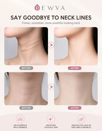 RF & EMS Facial Massager – Anti-Aging Skin Lifting Device