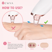 Electric Blackhead Vacuum Remover